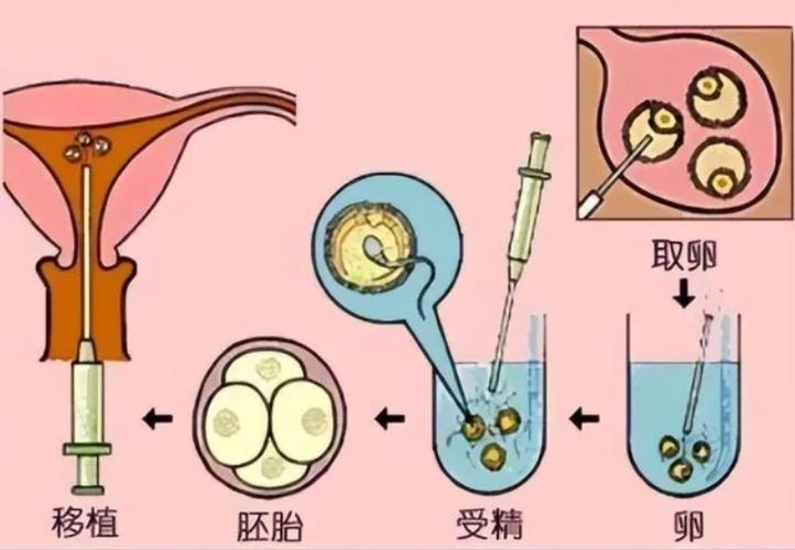 供卵代孕是什么